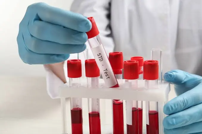 STD testing services at Well Health Labs