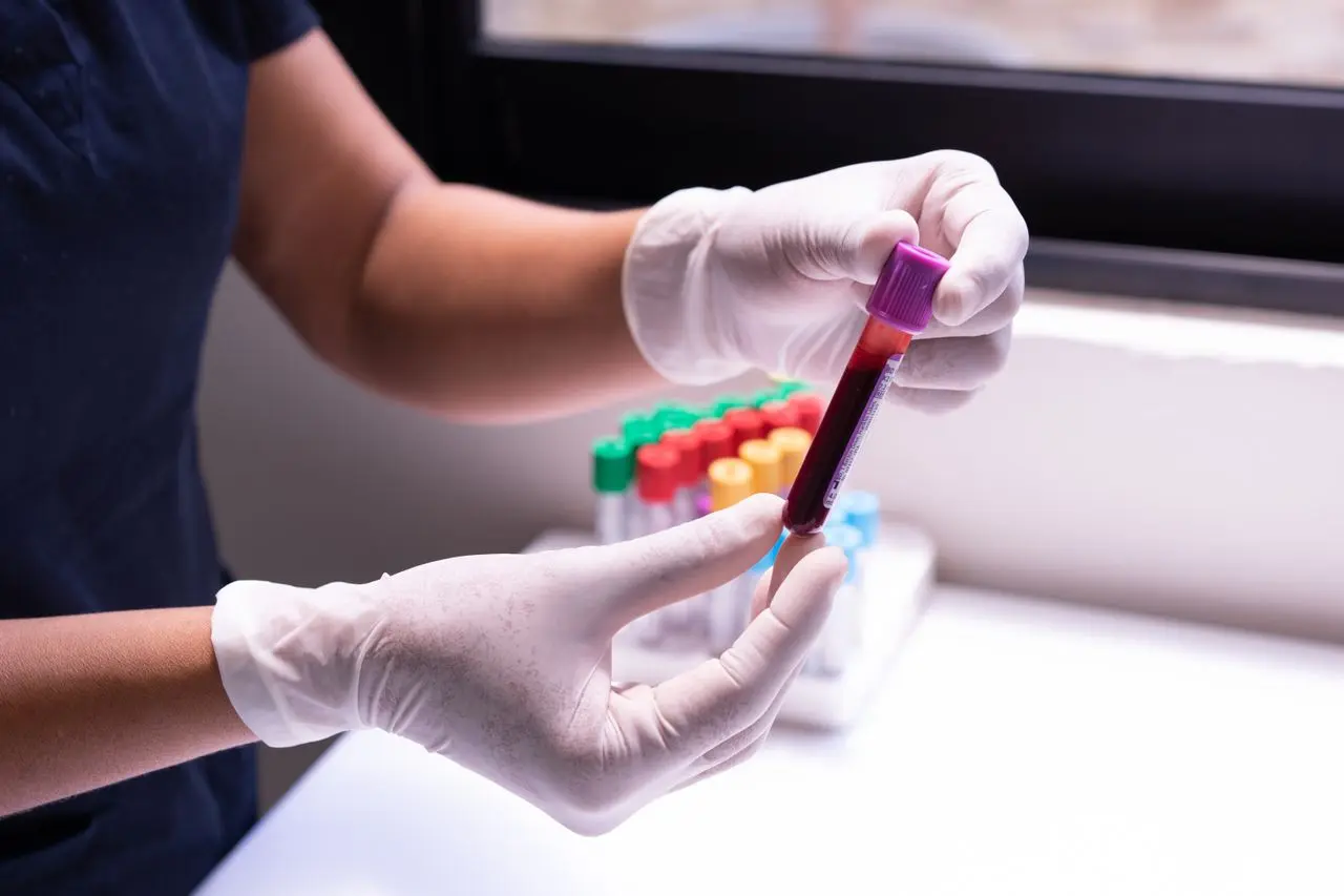 Laboratory professional preparing a blood sample for testing