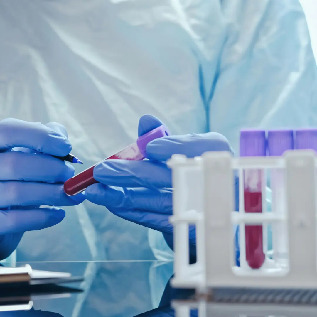 Specimen collection at Well Health Labs in Dallas, TX