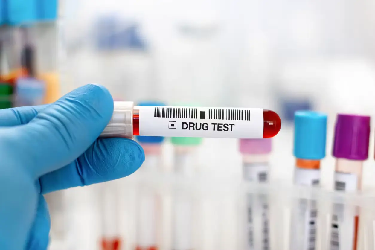 Urine toxicology drug screening