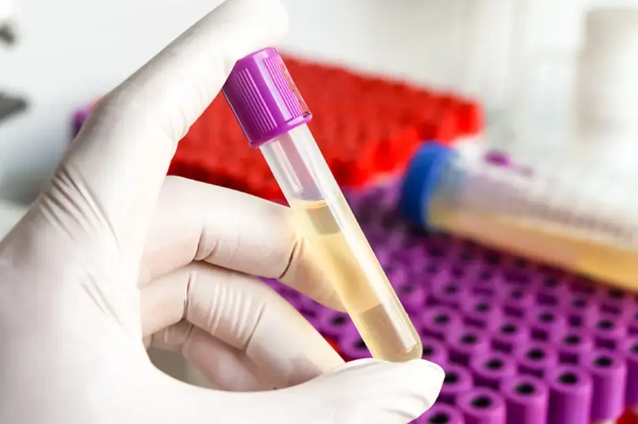 UTI testing at Well Health Labs